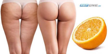 Апельсиновая корка целлюлит