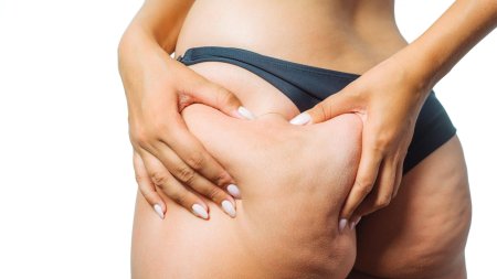 Попа с целлюлитом