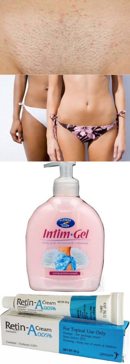 Интимный гель антибактериальный