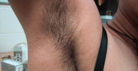 Волосы на подмышках у мужчин