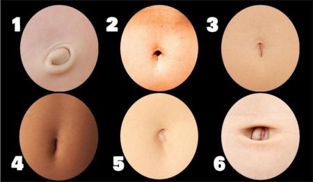 Формы пупков