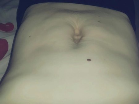 Выпуклые пупки