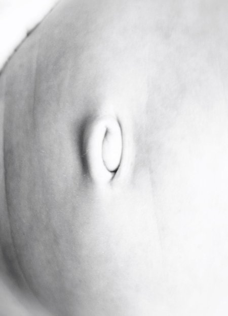 Пупочная грыжа у детей