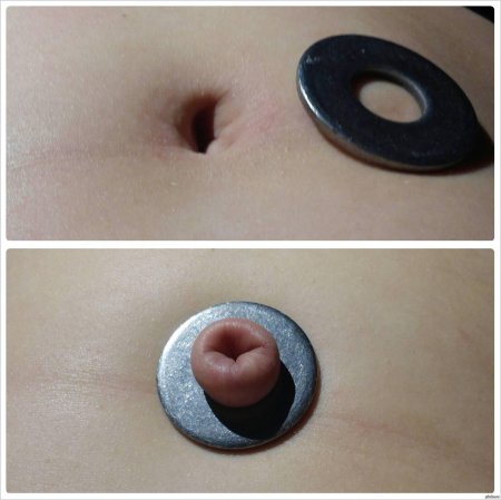 Пупки наружу