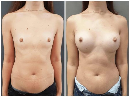 Красивая каплевидная грудь