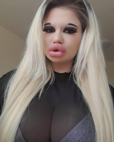 Девушка с самыми большими губами