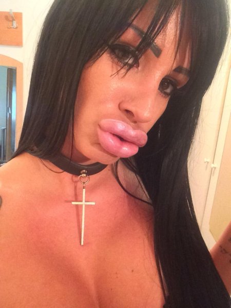 Девушки с накаченными губами