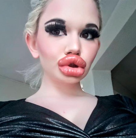 Женщина с самыми большими губами