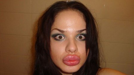 Самые большие губы в мире