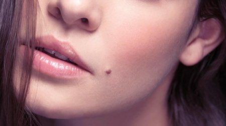 Родинка над губой