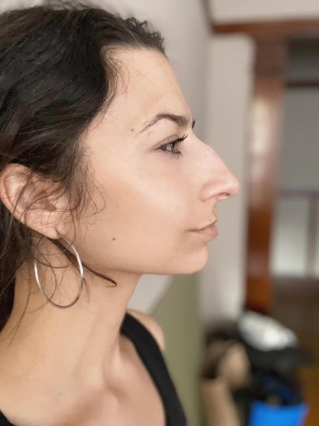 Лия стеффи нос