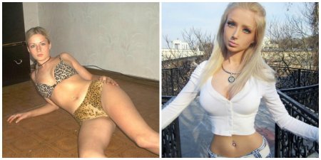 Валерия лукьянова до операции