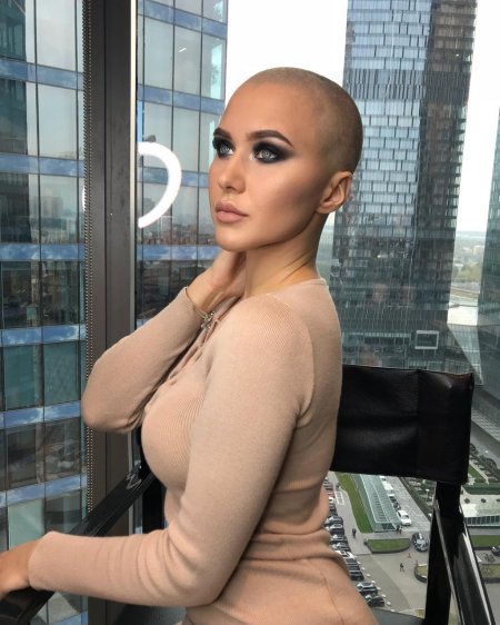 Лысые женщины