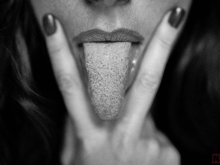 Язык белый налет