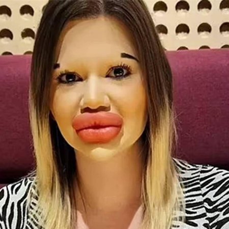 Женщина с самыми большими губами