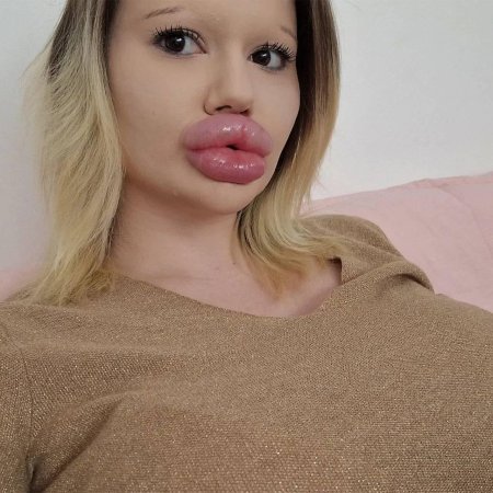 Женщина с самыми большими губами