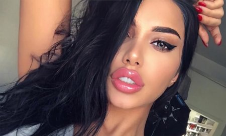 Губошлепка кайли