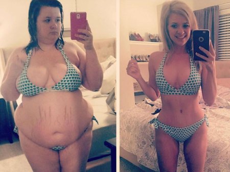 Грудь после похудения