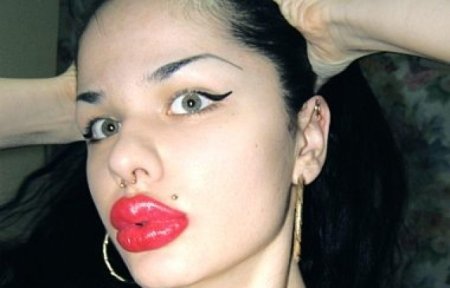 Самые большие губы в мире