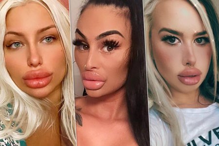 Огромные губы