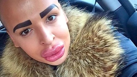 Девушка с перекаченными губами