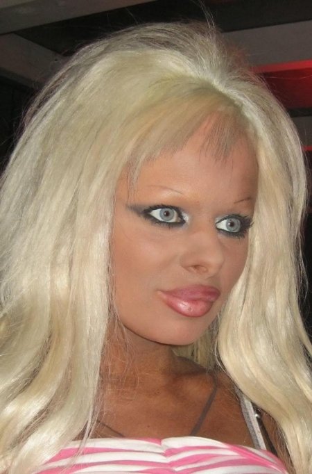 Олеся малибу до пластики