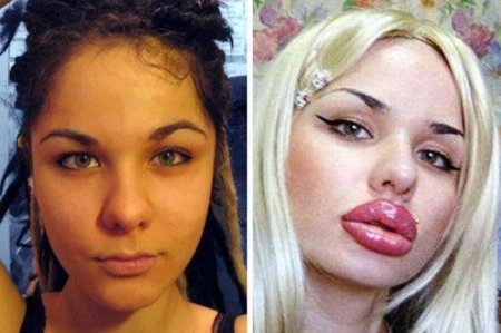 Накаченные губы