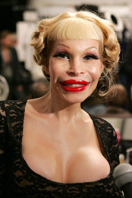 Неудачная пластическая операция