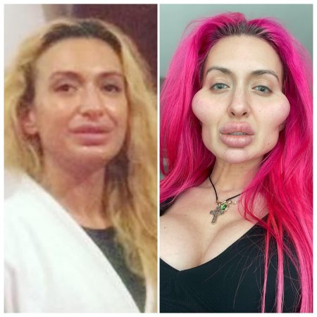 Девушка с перекаченными губами