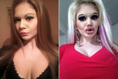 Андреа иванова до и после пластики