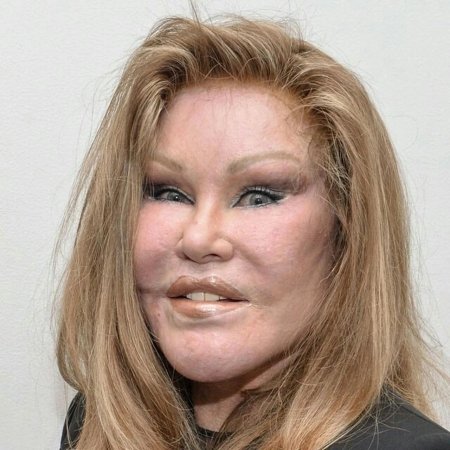 Вильденштейн джослин