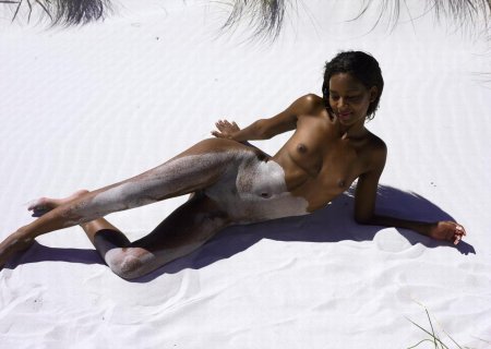 Модель с витилиго винни харлоу