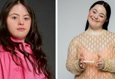 Девочка с синдромом дауна