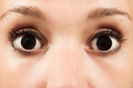 Широкие зрачки