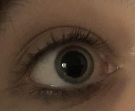 Глаза с большими зрачками