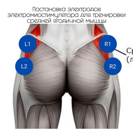 Средне ягодичная мышца