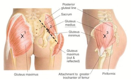 Gluteus medius мышца