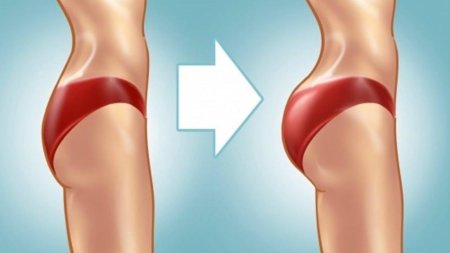 Плоские ягодицы