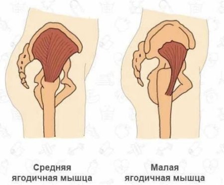 Средняя и малая ягодичные мышцы функции