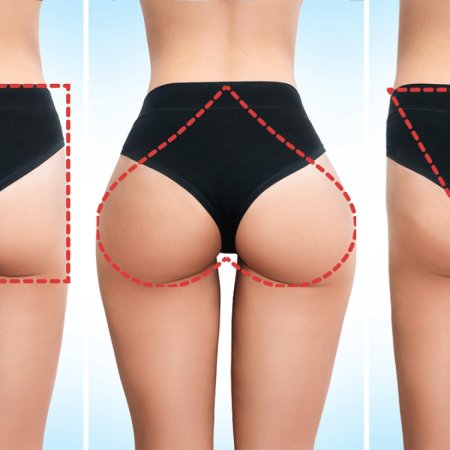 Форма ягодиц