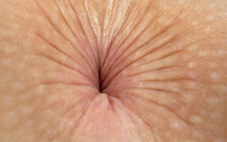 Отбеленный анус