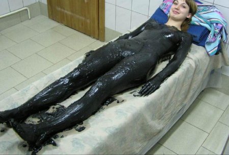 Пелоидотерапия (грязелечение)