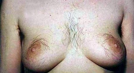 Волосатые женские сиськи