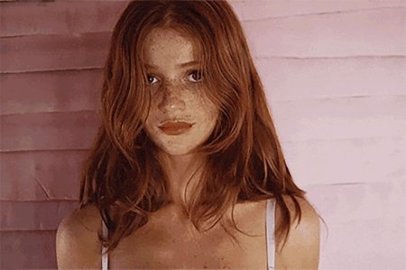 Redhead freckles