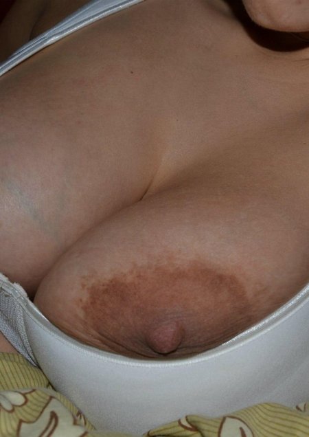 Молочная грудь