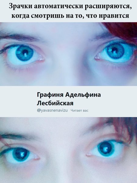 Широкие зрачки у человека