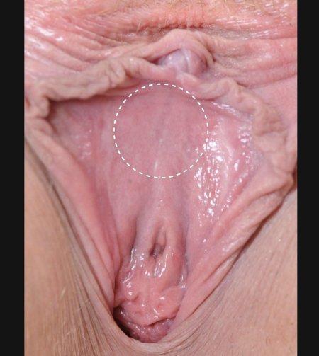 Здоровое влагалище