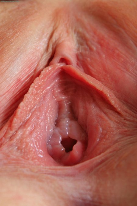 Полости гортани