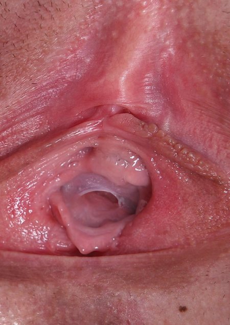 Девственная плев