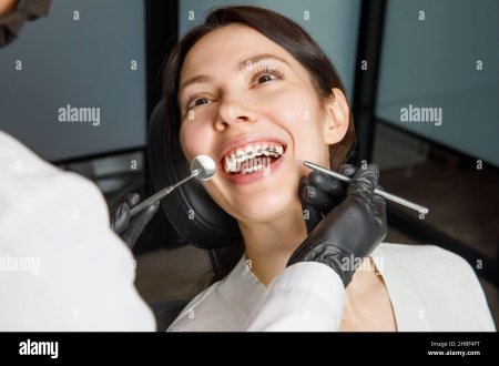 Зубы брекеты